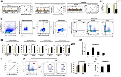 Tumor Arrests DN2 to DN3 Pro T Cell Transition and Promotes Its Conversion to Thymic Dendritic Cells by Reciprocally Regulating Notch1 and Ikaros Signaling